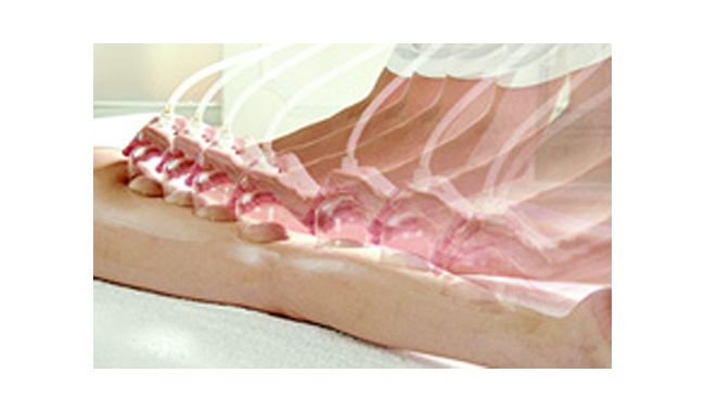 カップドレナージュ