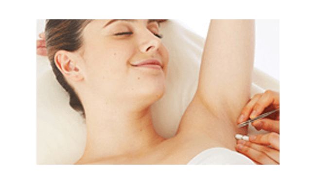 安全性と確実性! 「美容電気脱毛」