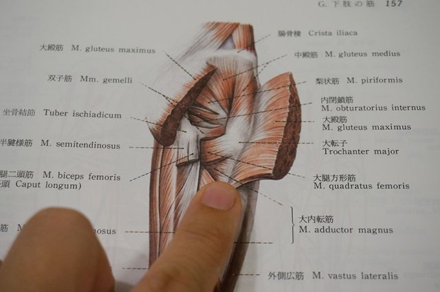 切れた筋肉の断面図に似ている
