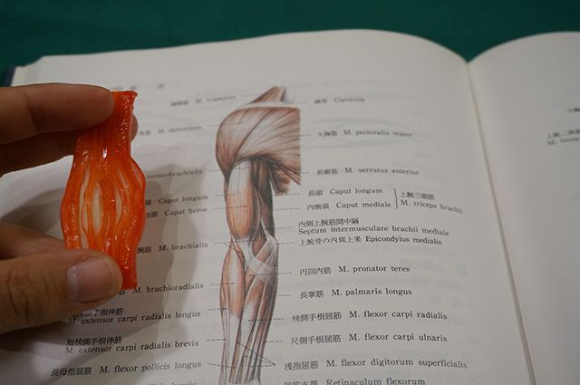 はい、筋肉です
